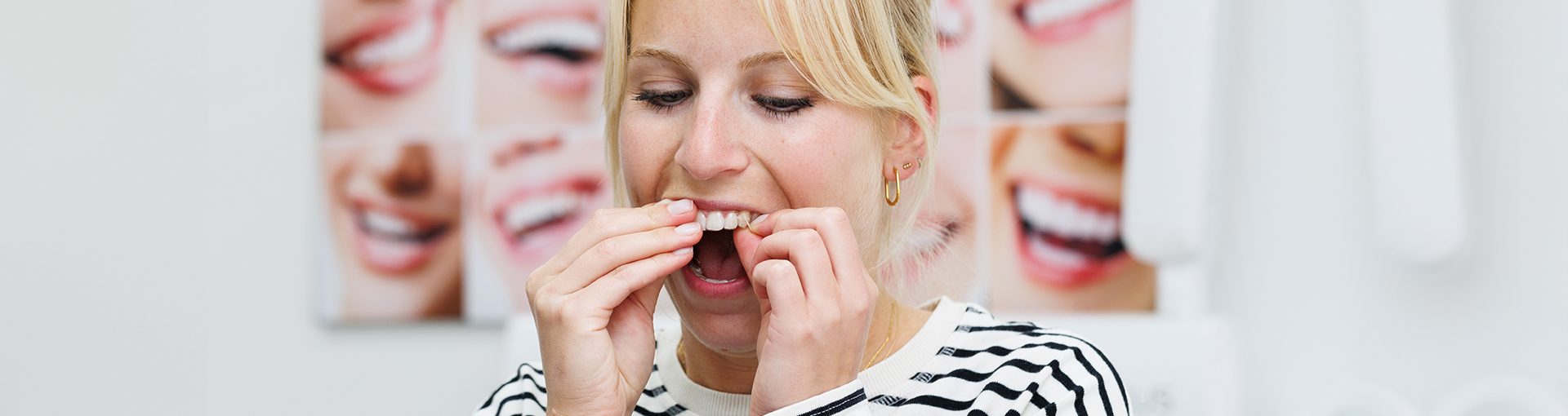 Transparante aligner